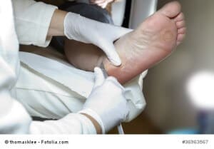 Medizinische Fußpflege - Foot care - Chiropody