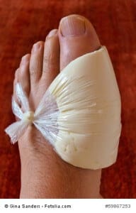 Ein Wickel aus Quark gegen Gicht, Hausmittel versus Schulmedizin