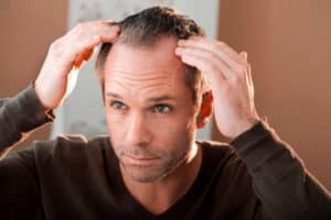 Warum eine Haartransplantation in der Türkei